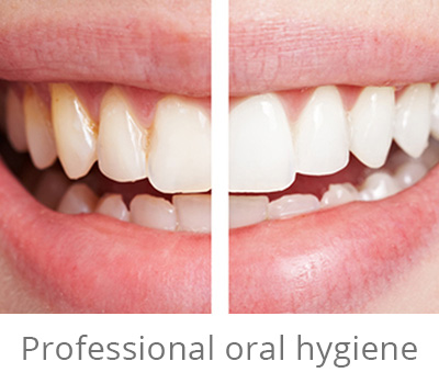 Igiena orala profesională